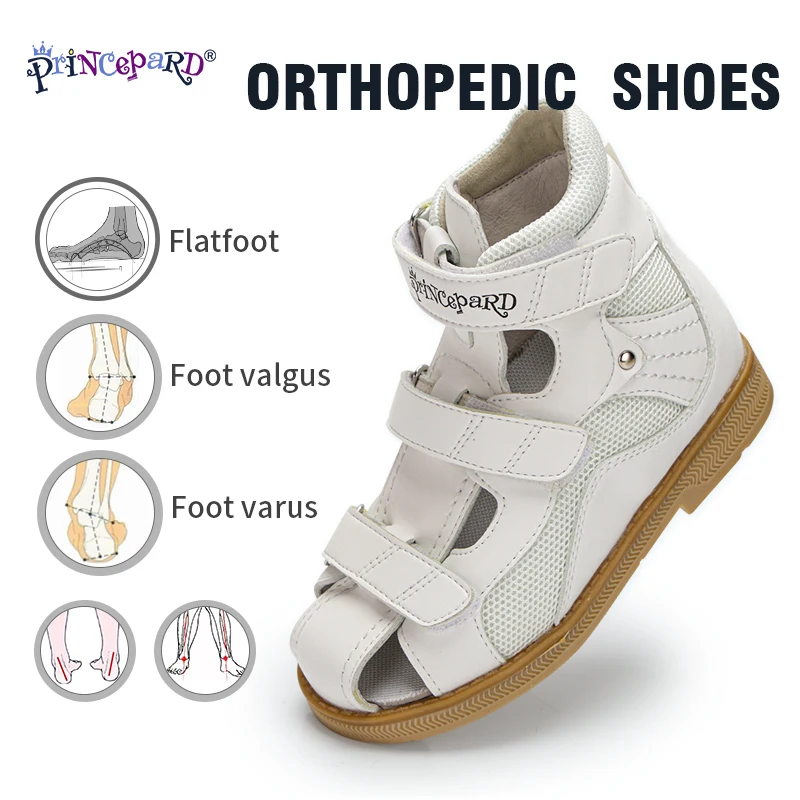 Top Trends: Princepard Summer Kids Orthopedic Sandals Boys Girls Genuine Leather Footwear Toddler Walking Correcting Shoes With Arch Support Shoppable Styles