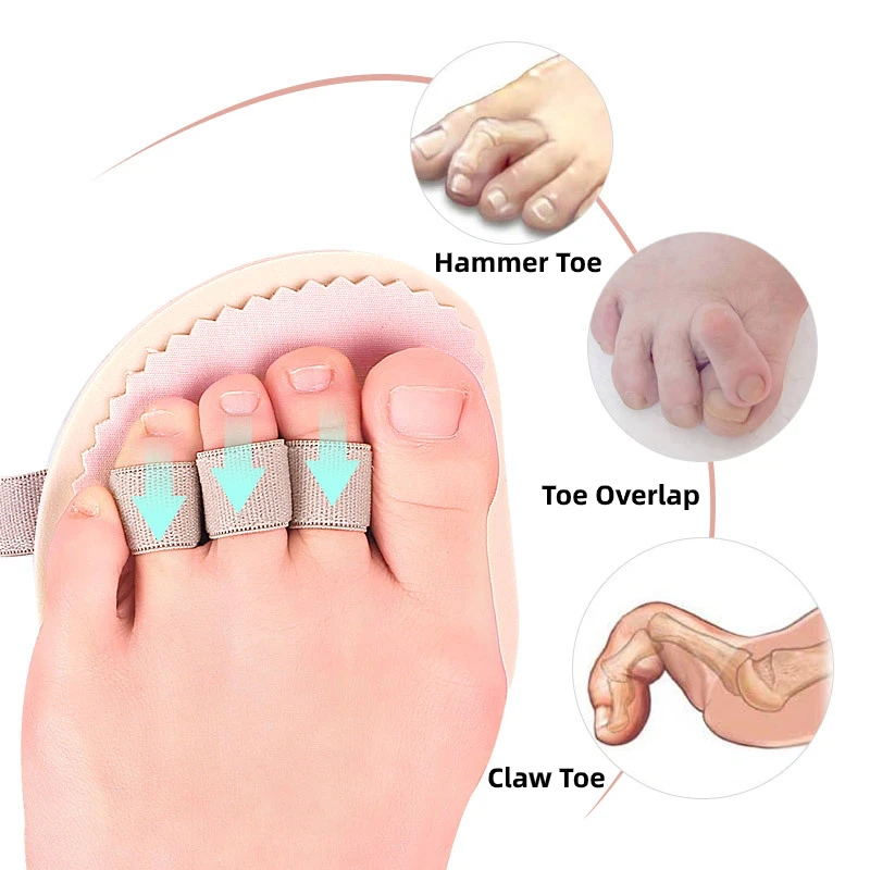 Top Trends: 1Piece Unisex Hammer Toe Cushions Protector Separator Support Pads Temporary Corrector Straightener Bunion Guard Foot Spacers Shoppable Styles