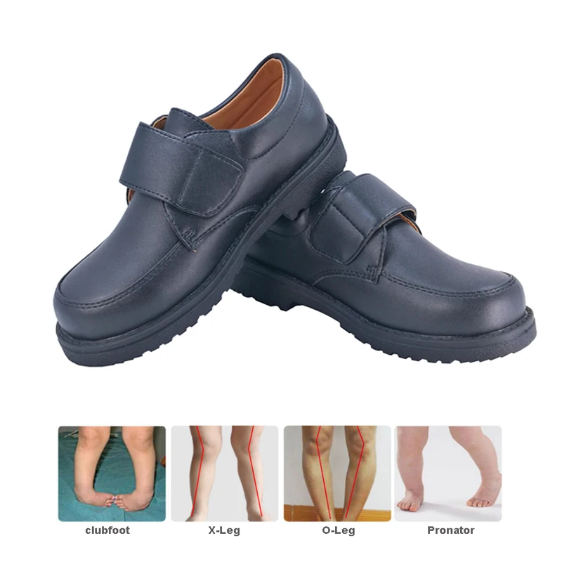 Top Trends: Children's Casual Shoes Kids Leather Orthopedic Footwear British Boys Students Black School Uniform Flats Sandals 8 Years Old Shoppable Styles - Image 2