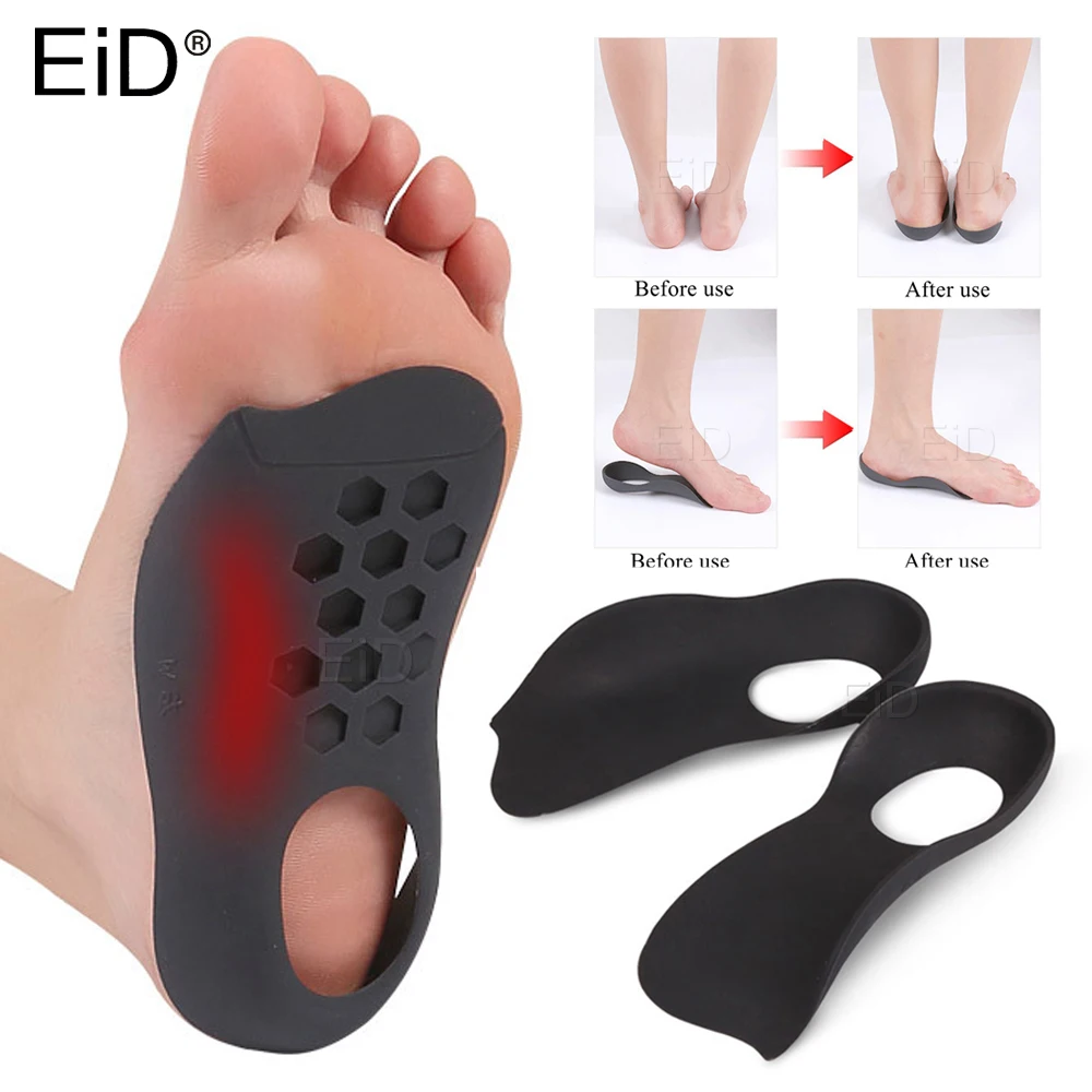 Top Trends: XO-Legs Orthopedic Insoles Orthotics Flat Foot Health Sole Pad For Shoes Insert Arch Support Pad For Plantar Fasciitis Feet Care Shoppable Styles