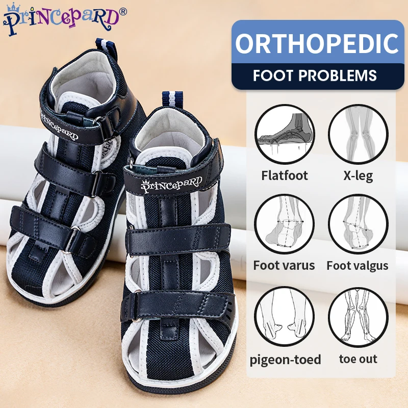 Top Trends: Princepard 2022 Children Orthopedic Shoes For Flat Feet Summer Kids Footwear Closed Toe Boys Girls Sandals With Ankle Support Shoppable Styles