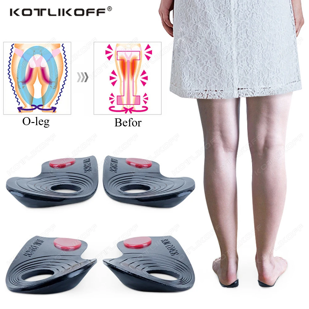 Top Trends: Self-Adhesive Orthopedic Insoles O / X Legs Correction Insoles Effective Improve Leg Shape Bowed Legs Knee Valgum Health Care Pads Shoppable Styles