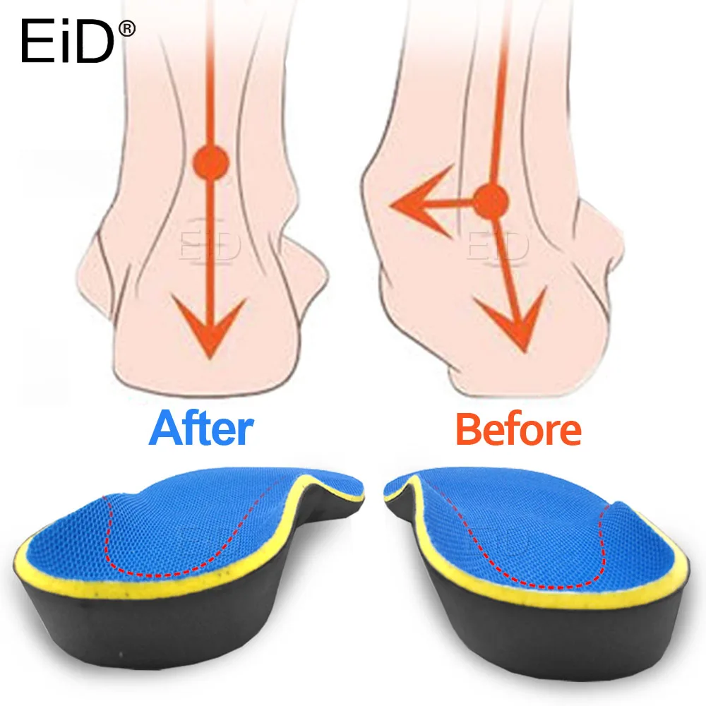 Top Trends: EiD 3D Orthotic Insoles Flat Feet Arch Support Orthopedic Inserts Plantar Fasciitis Feet Pain Pronation For Men Women Unisex Shoppable Styles