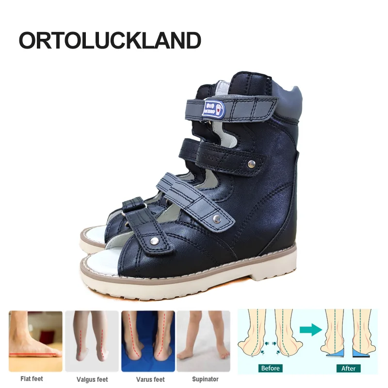 Top Trends: Boy Sandals Orthopedic Shoes For Kid High Top Summer Leather Children Toddler Correct Supinator Pronator Flatfeet Shoppable Styles