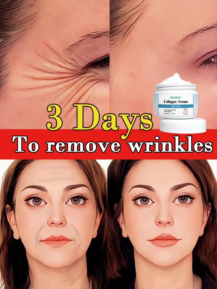 Top Trends: Wrinkle Reduce Cream Face Remove Nasolabial Folds Expression Lines Shoppable Styles