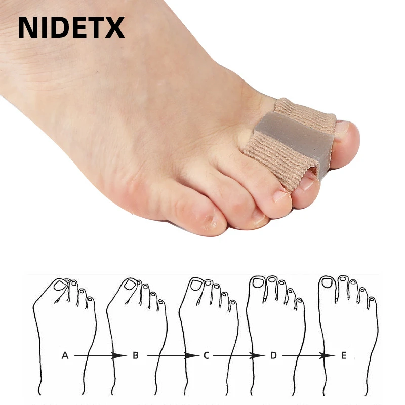 Top Trends: 1Pcs Silicone Toe Spreader Finger Separator Bunion Hallux Valgus Corrector Thumb Correction Straightener Foot Care Orthopedic Shoppable Styles