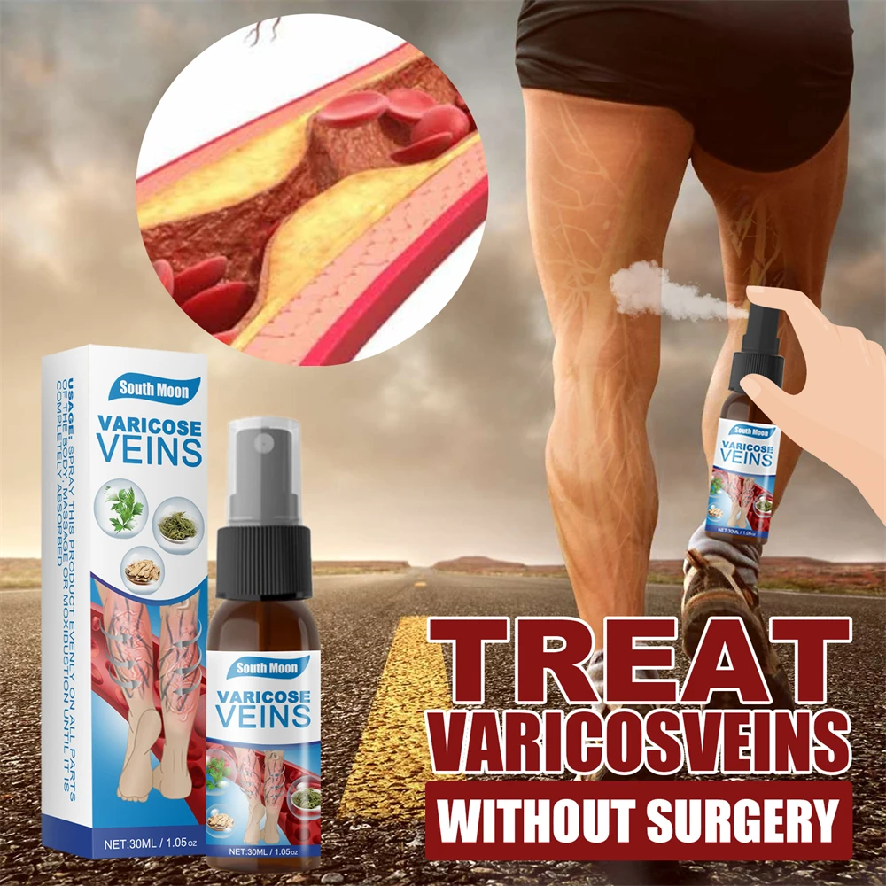 Top Trends: 30ml Varicose Vein Spray Vasculitis Phlebitis Spider Legs Smoothing Blood Vessel Bulging Treatment Redness Leg Body Care Shoppable Styles