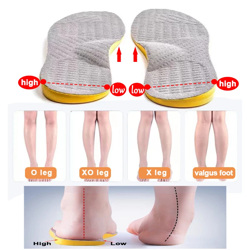 Top Trends: O / X-leg Flat Foot Orthopedic Insoles Unisex Inside Outside The Eight-character O-shaped Leg Correction Valgufoot Full Sports Pad Shoppable Styles