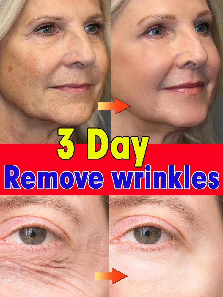 Top Trends: Anti-wrinkle Facial Serum Remove Facial Eye Wrinkles Anti Aging Shoppable Styles