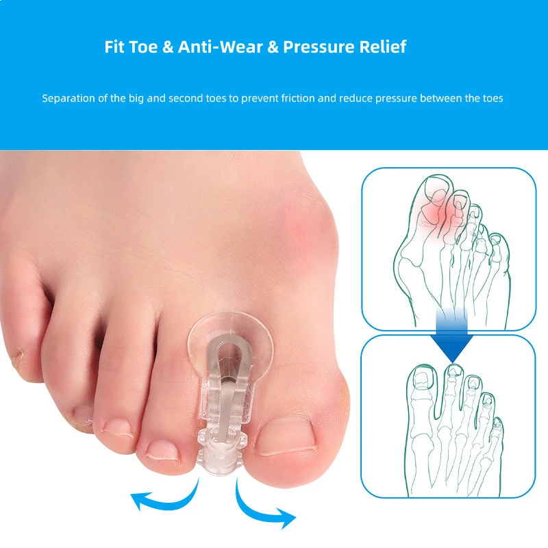 Top Trends: 2pieces=1pair Toe Orthosis Clip Pads Big Foot Bone Care Tools Splitter Thumb Hallux Valgus Bunion Corrector Overlap Separators Shoppable Styles