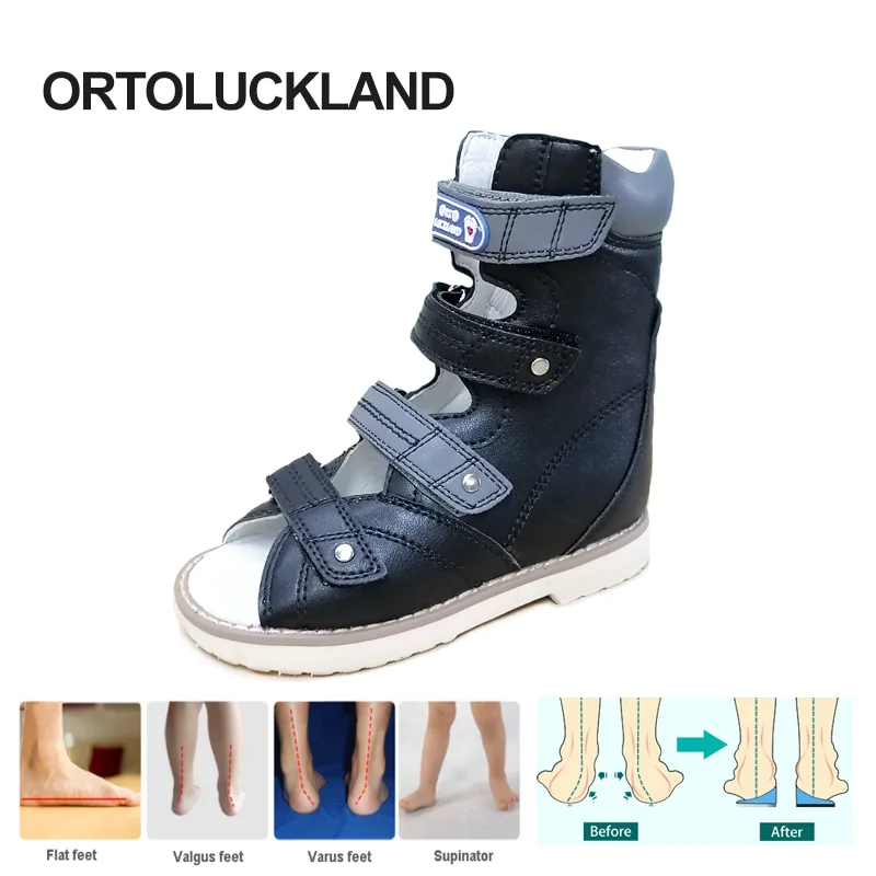 Top Trends: Ortoluckland Kid Girls Shoes Summer 2024 Orthopedic Sandals For Children Boys Toddlers High Top Clubfoot Arch Support Footwear Shoppable Styles